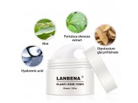 كريم LANBENA NOSE لإزالة زوان الانف